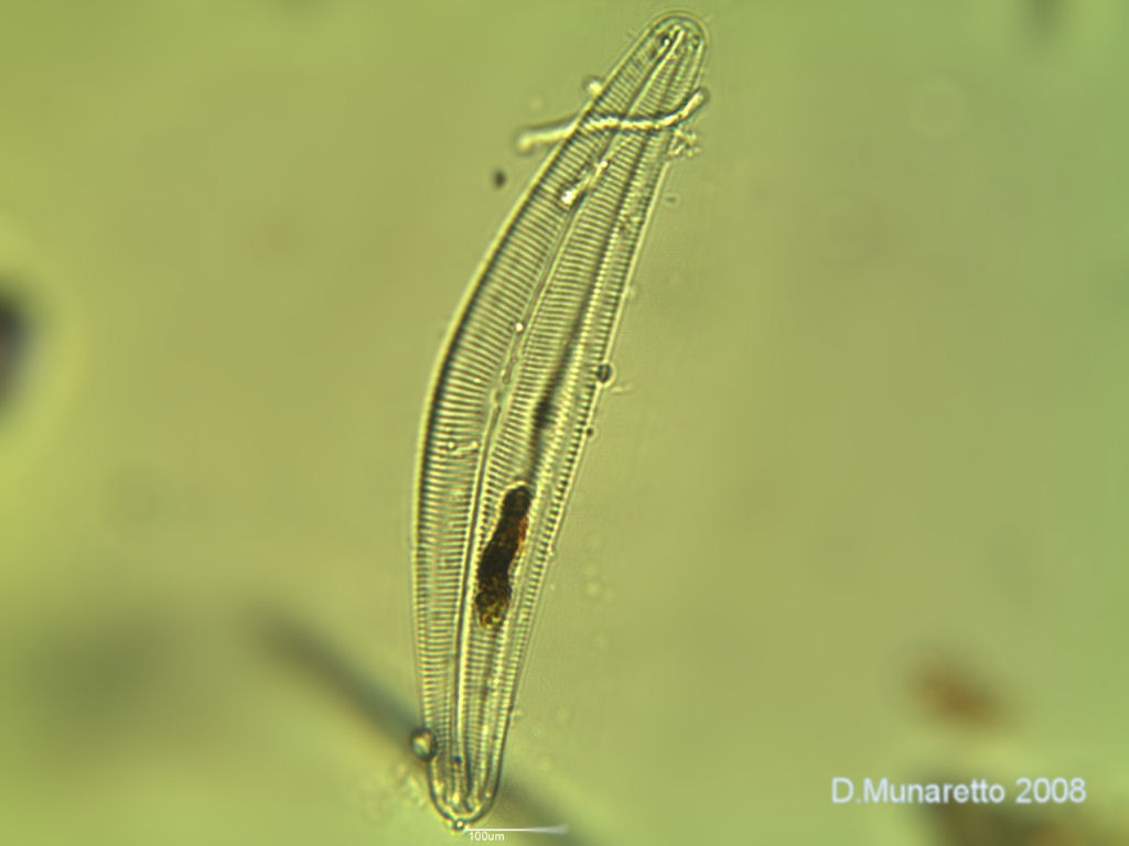 Cymbella sp.